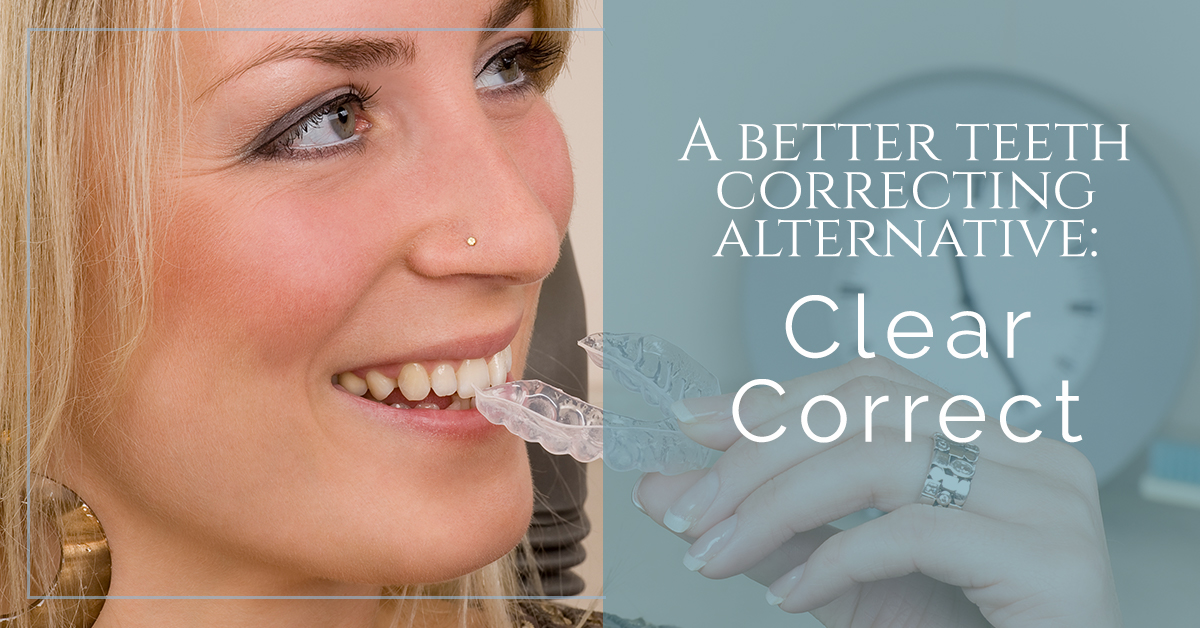A-Better-Teeth-Correcting-Alternative-Clear-Correct-5a72234994817 A-Better-Teeth-Correcting-Alternative-Clear-Correct-5a72234994817